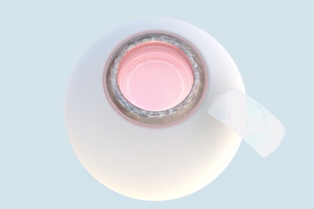 PRL手術(shù)是什么意思？